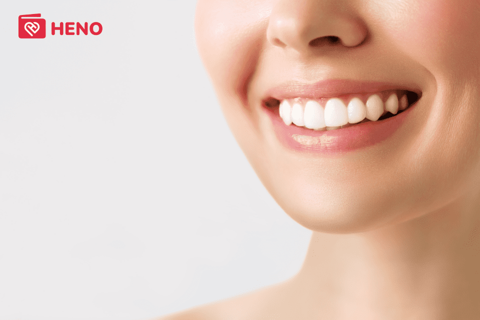 Góc giải đáp: Tẩy trắng răng có hại tới men răng không?